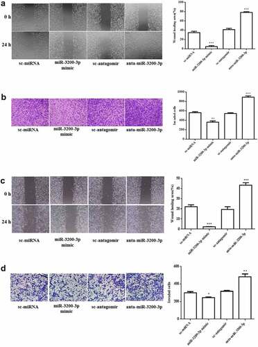 Figure 3. Role of miR-3200-3p on glioma cell metastasis. (a) The U251 cell migratory ability was examined. Representative images (left) showed the migrative cells at 0 and 24 h, and representative quantitative analysis (right) was the relative migration length established from three randomly selected locations. (b) U251 cell invasion was examined by transwell Matrigel invasion assay. (c,d) SHG-44 cell migratory and invasion. Representative images (left) and quantitative analysis (right) of cell invasive ability were exhibited. **p < 0.01 and ***p < 0.001 vs. control groups.