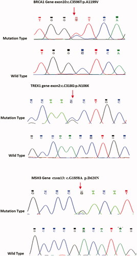 Figure 1. Sanger Sequence of Exon11 of BRCA1, Exon2 of TREX1, and Exon13 of MSH3, the Arrow Showing Mutations.