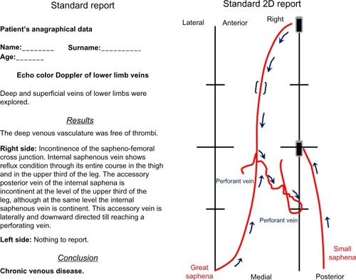 Figure 1 Comparative representation of the standard report on paper (scheme on the left) and a two-dimensional (2D) report (scheme on the right).