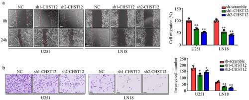 Figure 5. Knockdown of CHST12 inhibited the mobility of GBM cells. (a) Wound healing assay was used to detect the migration of CHST12 knockdown group and negative control (NC) group. The white line indicates a measurement of 250 μm. (b) Transwell assay was used to detect the invasion of CHST12 knockdown group and NC group. The black lines indicate a measurement of 100 μm.*P < 0.05; **P < 0.01