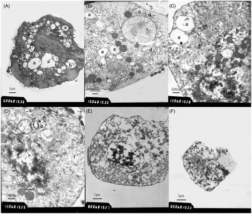 Figure 2. Transmission electron micrographs of A. tsao-ko essential oil-treated T. vaginalis. Transmission electron micrographs of T. vaginalis cell treated with sub-MLC A. tsao-ko essential oil (44.97 µg/ml) for 1 h were shown in (A–F). Vacuoles (a), autophagic vacuoles (b), perinuclear space widening (c), swollen rough surfaced endoplasmic reticulum (d), chromatin accumulation (e), ribosomes disappearing (f), organelles disintegration (g), damaged cytoplasmic membrane (h), nuclear envelope disappearing (i), nuclei dissolving (j), and cytoplasmic leakage (k) were observed.