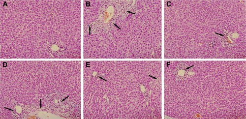 Figure 4 Effect of PLP on histological changes in the liver tissue of ANIT-induced rats.