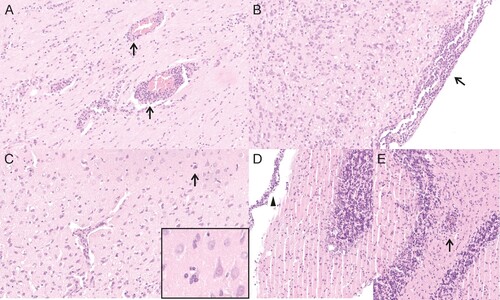 Figure 4. Histological lesions detected in neonatally intracerebral infected Lewis rats. (A) animal 4/#6, cerebral cortex, meningoencephalitis with mononuclear perivascular infiltrates (arrows). (B) animal 4/#6, brain stem, meningoencephalitis with mononuclear meningeal infiltrates (arrow). (C) animal 4/#6, cerebral cortex, meningoencephalitis with mononuclear perivascular infiltrates and satellitosis (arrow and insert). (D) animal 4/#10, cerebellum, meningoencephalitis with mononuclear meningeal infiltrates (arrowhead). (E) animal 4/#10, cerebellum, meningoencephalitis with mononuclear perivascular infiltrates (arrow).