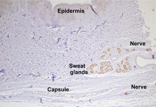 Figure 3 Photograph of histologic slide of saphenous nerve in the joint capsule.
