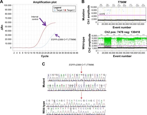 Figure 3 Analysis of EGFR T790M mutation using RT-PCR, ddPCR, and Sanger sequencing.