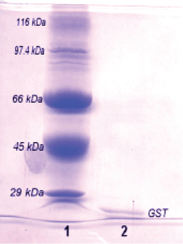 Figure  1.  SDS-PAGE of pure human erythrocytes GST. Lane 1, Molecular mass standarts; lane 2, The enzyme purified from human erythrocytes by Glutathione-Agarose affinity column.