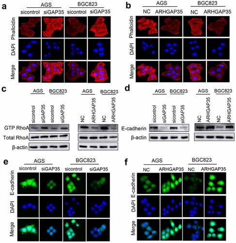 Figure 3. ARHGAP35 regulates cytoskeletal reorganization and epithelial-to-mesenchymal transition by targeting RhoA and E-cadherin, respectively. a-b, GC cell cytoskeleton staining was performed using phalloidin. c, The protein expression levels of RhoA and GTP-RhoA were detected by western blot analysis. d, The protein expression levels of e-cadherin were determined in ARHGAP35-depleted or -overexpressing GC cells using western blot analysis. e-f: The expression of the epithelial marker, e-cadherin, in GC cells was assessed by immunofluorescence staining. ARHGAP35, Rho GTPase‑activating protein 35; GC, gastric cancer.