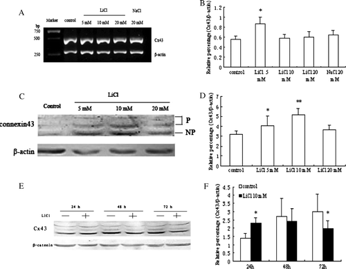 Figure 1.  The effects of LiCl on Cx43 expression in myoblasts. (A) RT-PCR analysis of Cx43 mRNA expression in different treatment groups. (C) Western blot analysis of Cx43 expression in skeletal myoblasts with various concentration of LiCl treatment. (E) Treatment with 10 mM LiCl from 24 to 72 h. Cx43 was detected as three bands corresponding to the phosphorylation states and unphosphorylation states of this connexin. (B, D, F) Quantitative analyses of Cx43 mRNA and protein expression are shown in the graphs as relative percentage (means±SEM) from n =3–4 independent experiments. *p < 0.05 and **p < 0.01 versus untreated cells.