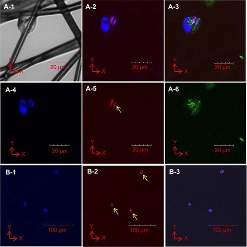 Figure 5 Cell proliferation of EPCs in 3D electrospun fiber scaffolds after 3 days of culture.Notes: Light microscopy image of colonized cells attached to fibers (A-1). Immunofluorescent images of cell colonies (A-2 to A-6; cell nucleus [blue]), Ki-67 proliferation marker (red; yellow arrow), and actin filaments (green). A colony consists of two or three nuclei (A-4). One cell in a cell colony proliferates, as indicated by the presence of the Ki-67 marker (A-5) localized to the nuclei of the EPCs (A-2). Actin filaments did not elongate (A-6), as indicated by the oval shape of the cell colony (A-1 and A-6). Proliferation cell nucleus antigen (PCNA; red, yellow arrows, B-2) localized to the nuclei (blue, B-1) of each EPC colony (B-3).Abbreviations: 3D, three dimensional; EPC, endothelial progenitor cell; PCNA, proliferating cell nuclear antigen.