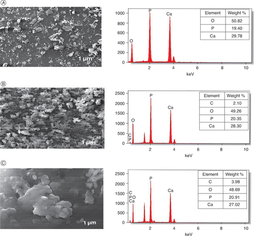 Figure 2. SEM (left panel) and EDX (right panel) analysis of calcium phosphate core (A), trehalose coated core (B) and Cephalothin loaded aquasome (C).SEM, which shows the presence of spherical calcium phosphate core in the nano range.μm: Micrometer; KeV: Kilo-electron volt; SEM: Scanning electron microscopy.