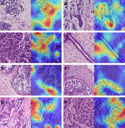 Figure 9 Visualization of different breast tissues by Grad-CAM.