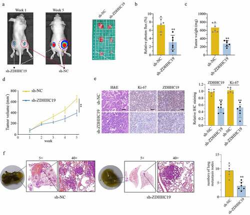 Figure 3. ZDHHC19 knockdown suppress tumor growth in vivo. (a) The tumor representative image from mice injected with OS cells transfected with sh-ZDHHC19 or sh-NC. (b) Relative photon flux analysis between sh-ZDHHC19 group and sh-NC group. (c) Tumor weight analysis between sh-ZDHHC19 group and sh-NC group. (d) Tumor volume analysis between sh-ZDHHC19 group and sh-NC group. (e) The representative staining images and expression levels analysis of ZDHHC19 and Ki-67 in tumors from sh-ZDHHC19 group and sh-NC group. (f) The representative images and quantitative analysis of lung metastasis between sh-ZDHHC19 and sh-NC group. All data are presented as the mean ± standard deviation of three independent experiments. *P < 0.05; **P < 0.01.