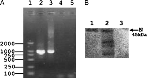Figure 4.  IBV identification by RT-PCR and Western blot assay. 4a: The S1 fragment of the IBV S protein amplified by RT-PCR. The S1 fragment (1025 nucleotides) was amplified from infected allantoic fluid (lane 2) and the fifth passage of IBV in HeLa cells (H5) (lane 3), but not from normal HeLa cells (lane 4) and distilled water (lane 5). Lane 1 represents the DNA ladder (DL2000). 4b: Western blot analysis of IBV propagated in HeLa cells. The viral proteins were separated by sodium dodecyl sulphate-polyacrylamide gel electrophoresis (10%), transferred to nitrocellulose membrane and analysed by western blotting with rabbit antiserum to IBV. Lane 1, purified virus from HeLa cell culture of passage 21; lane 2, passage 8; lane 3, uninfected cell culture. The arrow shows the most abundant viral protein, the nucleoprotein protein (N), with a molecular mass of 45 kDa.