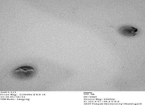 Figure 6. TEM photomicrograph of ligand anchored solid fat nanoemulsions.