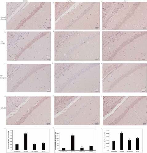 Figure 2. The distribution of Aβ, p-Tau and CD11b immunolabeling across the brains in the AD+TG, AD+donepezil, AD model and Normal control groups. (a–e): The distribution of Aβ immunolabeling in the AD+TG, AD+donepezil, AD model and Normal control groups. (f–j): The distribution of p-Tau immunolabeling in the AD+TG, AD+donepezil, AD model and Normal control groups. (k–o): The distribution of CD11b immunolabeling in the AD+TG, AD+donepezil, AD model and Normal control groups. Data was expressed as the mean ± standard error of the mean (SEM). (n = 8/group in the AD+TG group; n = 8/group in the AD+donepezil group; n = 8/group in the AD model group; n = 8/group in the Normal control group). ‘**’ indicating significant inter-group difference. TG: Tripterygium glycoside; AD: Alzheimer disease; NS: normal saline