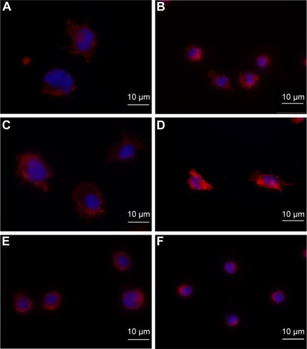Figure 10 Fluorescence staining of the F-actin cytoskeleton of MM6 cells and primary monocytes with and without incubation with nanoparticles.Notes: F-actin staining of the (A, C, and E) MM6 cell line or (B, D, and F) primary monocytes. Cells were stained with Alexa Fluor 555-coupled phalloidin (red) to visualize the actin cytoskeleton and DAPI (blue) for the nucleus. Cells not incubated with nanoparticles are shown in (A) and (B), whereas cells incubated with 500 ng/mL PLGA nanoparticles are shown in (C) and (D) and those incubated with the same amount of SPIONs for 4 hours are shown in (E) and (F).Abbreviations: DAPI, 4′,6-diamidino-2-phenylindole; PLGA, poly(lactic-co-glycolic acid); SPIONs, starch-coated superparamagnetic iron oxide nanoparticles.