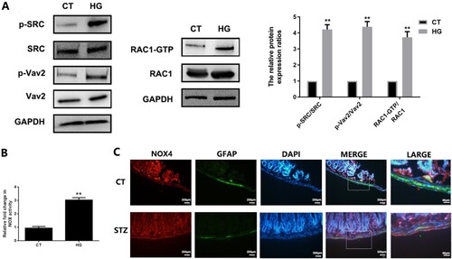 Figure 3. Hyperglycemic stress induces redoxosomes activation in EGCs in vitro and in vivo. A&B: CRL-2690 cells were treated with high glucose (200 mM) for 6 h or 12 h. The expressions of redoxosomes-related proteins were assessed using western blot analysis. NOX activity was evaluated using DCPIP assay. CT: control (5.6 mM), HG: high glucose (200 mM). C: The samples of duodenum tissues were collected from CT and DM mice. The expressions of NOX4 in EGCs were assessed using immunofluorescence analysis (NOX4: red fluorescence, GFAP: green fluorescence, DAPI: blue fluorescence). ** p < 0.01 vs. CT. CT: control (<100 mg/dL); STZ: DM (>300 mg/dL) (6 weeks post STZ-injection).