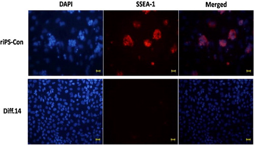 Figure 2. Immunofluorescence staining images for SSEA-1. Nuclei was stained with DAPI in blue color (left). Cytoplasm was stained with SSEA-1 in red color (middle). After merging the two images, the two colors displayed in one image (right). Cells in the riPS-con group positively expressed SSEA-1 (middle, up), which not observed in the cells from the Diff. 14 group (middle, down). 750 × 380 mm (300 × 300 DPI). Scale bar, 200 μm.