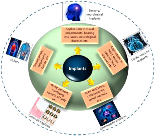 Figure 1. Implants are categorized according to their intended use, including cardiac grafts, orthopedic implants, cosmetic implants, neurological/sensory implants, and other uses offered. Using conventional metallic/nonmetallic materials, various engineering techniques have been found to imitate physical characteristics, chemical features, and gradient architecture of tissue or organs. Reproduced with permission from (Kumar et al., Citation2020).