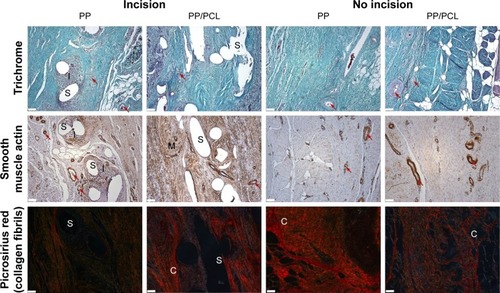 Figure 6 Typical histological findings in the “incision” and “no incision” areas.Notes: The stitches (S) of PP samples were surrounded by the infiltrated with inflammatory cells (I). The PP/PCL sample contains a smaller number of actin-positive vessels (red arrows), greater fraction of actin-positive myofibroblasts (M) and collagen type I (C) at the incision areas. Magnification 10×, scale bars 100 μm.Abbreviations: PCL, poly-ε-caprolactone; PP, polypropylene mesh; PP/PCL, composite scaffold composed of polypropylene mesh and poly-ε-caprolactone nanofibers.