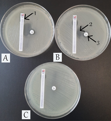 Figure 1 The photo illustrates the identification of synergism in vitro (plate (A and B) by qualitative method on Mueller-Hinton agar medium. Visible zone of inhibition of bacterial growth in the form of “inverted letter D”. Plate (C) – no synergism. Klebsiella pneumoniae CPE (NDM+ and OXA-48) strain was spread on the agar plates (A and B), Acinetobacter baumannii strain was used to demonstrate the lack of synergism.