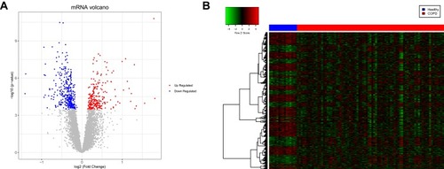 Figure 2 Volcano plot and heatmap displaying the differentially expressed genes (DEGs). (A) Volcano plot of the DEGs. The red and blue dots represent the upregulated and downregulated genes, respectively. (B) Heatmap of the DEGs. The red and blue sample strips represent the chronic obstructive pulmonary disease (COPD) and healthy samples, respectively.