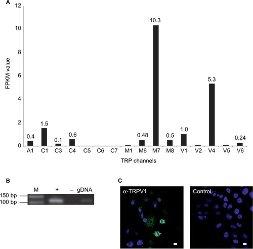 Figure 4 Expression profiles of TRP channels in the SUM149PT breast cancer cell line.