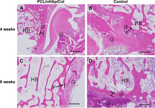 Figure 6 Histological visualization of interface between autologous tendon and host bone 4 or 8 weeks after ACL surgery in a rabbit model.Notes: (A and C) PCL/nHAp/Col-treated tendon group. (B and D) Non-treated autologous tendon group as a control. (H&E staining, ×200 magnification). Some inflammatory cells were observed at 4 weeks (white arrows). In PCL/nHAp/Col group, new bone growth into the interface was observed 8 weeks after surgery (black arrows). Scale bar =200 µm.Abbreviations: ACL, anterior cruciate ligament; Col, collagen; H&E, hematoxylin and eosin; HB, host bone; G, autologous tendon graft; IF, interface; nHAp, nanohydroxyapatite; PCL, polycaprolactone.
