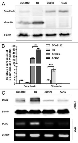 Figure 2. Expression of DDR2, E-cadherin, and vimentin in HNSCC cell lines. (A and B) Tca8113, TB, SCC25, and FaDu cells were subjected to analysis of mRNA and protein expression of E-cadherin and vimentin by qPCR and western blot, respectively. Statistical significance was evaluated with the Student t test. Results display the mean ± SD. ***P < 0.001. (C) mRNA and protein expression of DDR2 in HNSCC cell lines was analyzed by reverse transcription PCR and western blot, respectively. β-actin was used as a loading control.