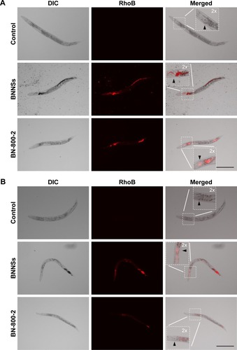 Figure 4 In vivo accumulation of BNNSs or BN-800-2 in Caenorhabditis elegans.Notes: (A) Representative fluorescent micrography of control (untreated) and L4-stage larvae after being treated with RhoB-labeled BNNSs or BN-800-2 (500 µg·mL−1) for 24 hours. Arrowheads indicate the pharynx. Inset images are enlargements of regions outlined by small boxes. (B) After being treated as in A, worms were transferred and cultured in pure K medium for defecation for 24 hours. (C) Quantification of average integrated optical density of RhoB in worms with persistent 24-hour exposure or worm-defecated materials for 24 hours after being treated as in A (n=50). (D) In vivo accumulation-assay procedure for exposure and defecation of BN materials. Worms were maintained in K medium in 24-well plates at 20°C in an incubator. Data presented as means ± SEM. **P<0.01. Scale bar 200 µm.Abbreviations: BN, boron nitride; BNNSs, boron nitride nanospheres; BN-800-2, highly water-soluble boron nitride; DIC, differential interference contrast; RhoB, rhodamine B; SEM, standard error of mean.