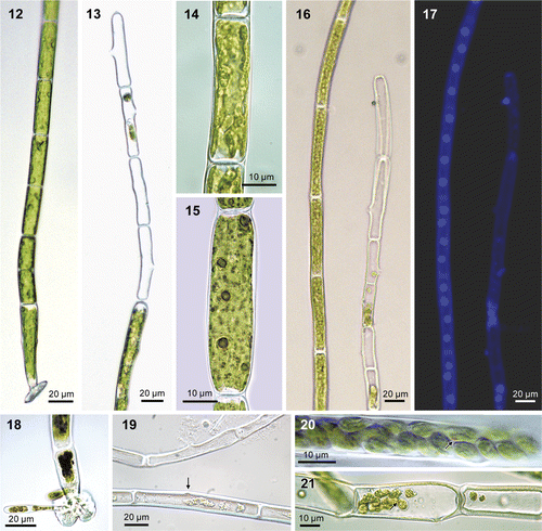 Figs 12–21. Urospora microscopica (=Chaetomorpha norvegica, nom. nov.), culture. Fig. 12. Filament with basal cell with attachment disc. Fig. 13. Apical portion of filament with sporangia and lateral exit pores. Fig. 14. Parietal, lobed chloroplast. Fig. 15. Cell showing pyrenoids following staining with iodide solution. Figs 16, 17. The same filaments after DAPI-staining as seen under light field and fluorescence microscopy, showing multinucleate cells with four nuclei in axial arrangement (note one spore attached outside the filament and a few spores left in sporangium). Fig. 18. Lobed attachment disc with germinating spores. Fig. 19. Sporangia with exit pore (top filament) and start of exit pore formation (bottom filament, arrow) (fixed material, without cell contents). Figs 20, 21. Sporangia with spores, red eye spot visible (arrows).