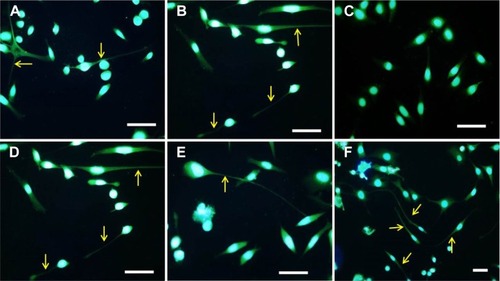 Figure 9 Morphology of PC-12 cells in different treatment groups observed under fluorescent microscopy.Notes: (A) Treatment with 50 ng/mL NGF. (B) Treatment with 50 μg/mL of HAE of H. erinaceus. (C) Negative control, (complete F-12 K medium). (D–F) Various concentrations of AuNPs ranged from 200 to 600 ng/mL. Nuclei stained blue and neurofilaments stained green. Scale bar =40 μm. Arrows indicate neurite extensions.Abbreviations: AuNPs, gold nanoparticles; NGF, nerve growth factor; H. erinaceus, Hericium erinaceus; HAE, hot aqueous extract.