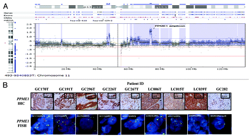 Figure 1.PPME1 gene amplification and protein expression levels in Chinese gastric cancer (GC) and lung cancer (LC) patient samples. (A) PPME1 gene amplification in a Chinese GC tumor detected by array comparative genomic hybridization. (B) PPME1 amplification and protein overexpression in GC and LC samples detected by FISH and immunohistochemistry (IHC) assays, respectively. PPME1 IHC score and PPME1 amplification status are embedded within the images (“AMP” denotes the gene amplified). For the fluorescence in situ hybridization analysis (FISH) images, the PPME1 gene probe signals appear red, CEP11 signals are green, and DAPI-counterstained nuclei appear blue. Scale bars represent 50 nm for H&E/IHC images and 30 nm for the FISH images. All images within each row are on the same scale.