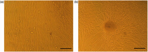 Figure 1. Morphological changes in 2 D culture. (a) hiPSCs in DMEM (control group) and (b) hiPSCs in IPC differentiation media. Scale bars are 100 µm.