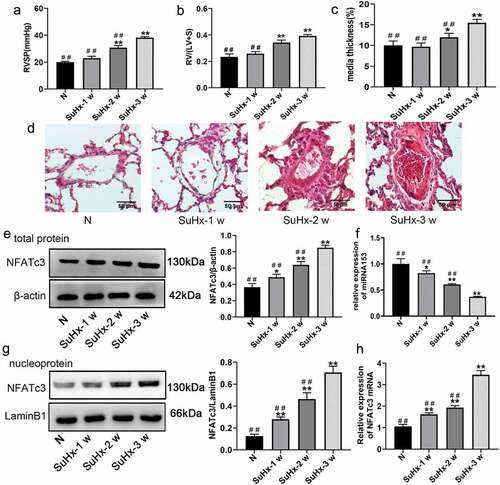Figure 2. SuHx successfully induces PH model and downregulates miRNA153 expression in pulmonary artery tissue. (a) RVSP was measured by right-sided heart catheterization with a pressure transducer microcatheter. (b) RV was dissected from the left ventricle and septum then weighted RV/(LV+S) ratio of each group. (c) The medial thickness percentage (MT%) of rat pulmonary arteries in normal and SuHx groups. (d) Representative images of hematoxylin-eosin (h&e) staining (70–100 μm, 400× magnification). (e, g) Western blot analysis of NFATc3 total protein and nucleoprotein in pulmonary artery tissues. (f, h) RT-qPCR analysis of miRNA153 and NFATc3 expression in the pulmonary artery tissue. N = 10 for each group. Comparisons were performed using one-way ANOVA followed by Bonferroni’s post hoc test. *P < .05, **P < .01 vs normal group (n); #P < .05, ##P < .01 vs SuHx-3 w group. The results are expressed as the mean ± SEM. SuHx, SU5416 combined with hypoxia; PH, pulmonary hypertension; miRNA153, microRNA153; RVSP, right ventricular systolic pressure; RV, right ventricle; LV, left ventricle; S, septum; H&E, hematoxylin and eosin RT-qPCR, quantitative real-time polymerase chain reaction; SEM, standard error of mean.