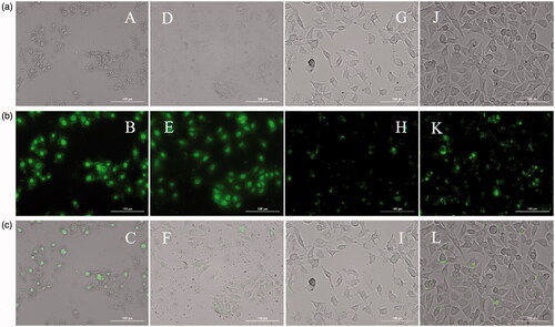 Figure 4. Live cell images. Row (a) Bright field (40×): A (R8-FAM, 25 µM), D (R8-FAM/E8, 25 µM), G (Mem-R8-FAM, 50 µM) and J (Mem-R8-FAM/E8, 50 µM). Row (b) Fluorescent (40×): B (R8-FAM, 25 µM), E (R8-FAM/E8, 25 µM), H (Mem-R8-FAM, 50 µM) and K (Mem-R8-FAM/E8, 50 µM). Row (c) Merged: C (R8-FAM, 25 µM), F (R8-FAM/E8, 25 µM), I (Mem-R8-FAM, 50 µM) and L (Mem-R8-FAM/E8, 50 µM).