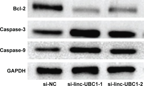 Figure 4 Results of the Western blot analysis of the levels of Bcl-2, cleaved caspase-3, cleaved caspase-9, and GAPDH.