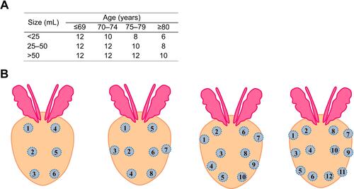 Figure 2 (A) Nomogram of the number of cores taken, age, and prostate volume. (B) The order of biopsies taken: the numbers in figure show the order of cores taken.