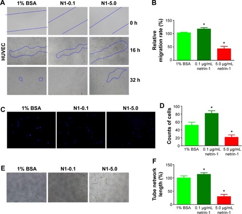 Figure 2 Effect of netrin-1 on HUVEC migration, invasion, and tube formation.