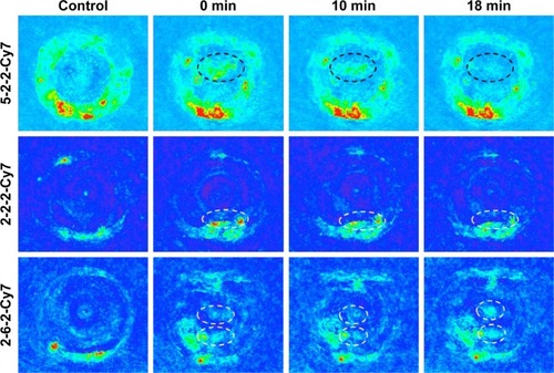 Figure 4 PA imaging of Cy7-labeled MPEG-PCL-g-PEI micelles in enucleated eyes.Notes: The red fluorescence signals might be blood vessels with nonspecific PA signals in the eyes. White and black circles designate the generated PA signal areas of Cy7-labeled amphiphilic micelles.Abbreviations: PA, photoacoustic; Cy, cyanine; MPEG, monomethoxy poly(ethylene glycol); PCL, poly(ε-caprolactone); PEI, polyethylenimine; min, minutes; 2-2-2, MPEG 2000 Da-PCL 2000 Da-PEI 2000 Da; 2-6-2, MPEG 2000 Da-PCL 6000 Da-PEI 2000 Da; 5-2-2; MPEG 5000 Da-PCL 2000 Da-PEI 2000 Da.