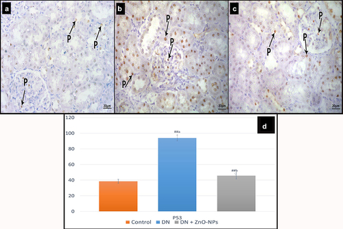 Figure 7. Immune histochemical-stained sections for P53 in the renal cortex of albino rats in the study groups. P53 nuclear immune reactions (p). a Control group, reaction appears in few cells. b DN group, showing the reaction in many cells. c DN + ZnO-NPs groups, showing the reaction in some cells. d The average count of brown nuclei in anti-p53 immune-stained sections. Estimates are displayed as mean ± standard errors (X ± SEM); a: P compared to control group; b: P compared to DN group; #: P< .05; ##: P< .001.