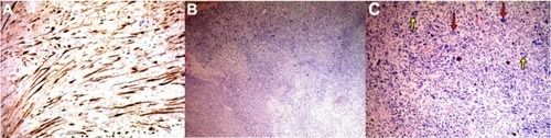 Figure 4 Appearance after histopathological and immunochemical staining.