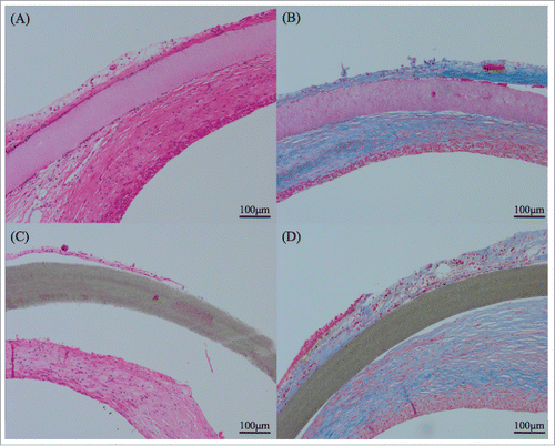 FIGURE 3. This figure was shown samples of 3 months. SF/Pellethane® patch was stained by HE method (A) and shown collagen fibers in blue color by MTC staining (B). ePTFE patch was showed separation from the tissue (C) and was not infiltrated by collagen fibers (D).