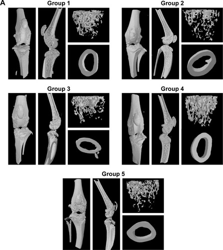 Figure 5 Micro-CT analysis.Notes: (A) Representative trabecular bone in micro-CT images of the distal femur in mice from different groups. (B) Cortical BMD in femur diaphysis. (C) Trabecular bone volume as percentage of total volume (BV/TV). (D) TbTh. (E) TbN. (F) TbSp. n=3. Values are the means ± SEM of three mice. Statistical significance was assessed by unpaired Student’s t-test, *P<0.05, **P<0.01, ***P<0.001. Group 1: normal control; group 2: CAIA control; group 3: CAIA mice treated with CH-DEAE15/siRNA-TNFα nanoparticles; group 4: CAIA mice treated with folate-PEG-CH-DEAE15/siRNA-TNFα nanoparticles; group 5: CAIA mice treated with siRNA-TNFα.Abbreviations: BMD, bone mineral density; BV, bone volume; CAIA, collagen antibody-induced arthritis; CH, chitosan; CTX-II, C-terminal telopeptide type II collagen; DEAE, diethylethylamine; ELISA, enzyme-linked immunosorbent assay; micro-CT, micro-computed tomography; PEG, polyethylene glycol; SEM, standard error of the means; TbN, trabecular bone number; TbSp, trabecular separation; TbTh, trabecular bone thickness; TNFα, tumor necrosis factor-alpha; TV, tissue volume.
