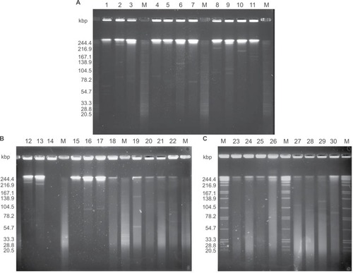 Figure 2 S1 endonuclease pulsed-field gel electrophoresis analysis of plasmids from the 30 VAP-inducing EPKP isolates in China.Notes: (A) “M” indicates the molecular weight marker; Lanes 1–11 show the plasmid profiles of isolates EPKP1–EPKP11, respectively; (B) Lanes 12–22 show the plasmid profiles of isolates EPKP12–EPKP22, respectively; and (C) Lanes 23–30 show the plasmid profiles of isolates EPKP23–EPKP30, respectively.Abbreviations: VAP, ventilator-associated pneumonia; EPKP, ESBL-producing Klebsiella pneumoniae; ESBL, extended-spectrum β-lactamase.