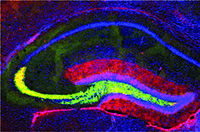 Cover image for Cell Adhesion & Migration, Volume 10, Issue 4, 2016