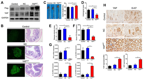 Figure 2 Overexpressed YAP promoted mucosal repair after DSS induced acute colitis. All mice were received 5 days 3%DSS induction followed by 5 days normal drinking water, and were sacrificed at 5d+5 for subsequent analysis (n=8 each), the experiments were carried out in three independent replications. (A) Western Blot analysis of indicated proteins in colons of control (PBS administrated mice), NC (negative control lentivirus-transfected mice) and YAPWT mice. (B) Histological analyzed the mucosal lesions among different treated groups, figures at the left column presented as the EGFR imaging under fluorescent microscopy. (C) Murine colon lengths of different treated mice at 5d+5. The Bar graph represented the statistical analysis of colon lengths among different groups. (D) Histological score of colonic mucosa of control, NC and YAPWT mice at 5 days DSS withdraw. (E) Disease Activity Index of control, NC and YAPWT mice at 5d+5. (F) Serum FITC-labelled dextran assessment of control, NC and YAPWT mice at 5d+5. (G)Real-time PCR analyzed the mRNA expression levels of cytokines of murine colons of control, NC and YAPWT mice at 5d+5. (H) IHC analysis of YAP expression in colonic epithelium of different treated mice at 5 days DSS withdraw. Bar graphs represented IHC statistical analysis from different groups. Scale bars =50μm. Data were presented as mean ± SEM, *P< 0.05, **P< 0.01.