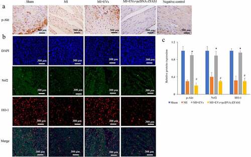 Figure 4. Activation of Akt/Nrf2/HO-1 pathway by EVs was markedly inhibited by pcDNA-ZFAS1. (a) The influence of EVs and ZFAS1 on p-Akt expression was detected via IHC in vivo; (b) The influence of EVs and ZFAS1 on Nrf2 and HO-1 expression was detected via IHC in vivo; (c) Activation of Akt/Nrf2/HO-1 pathway by EVs was markedly inhibited by pcDNA-ZFAS1 in vivo. * P < 0.05 compared with the group MI. # P < 0.05 compared with the group MI+EVs.