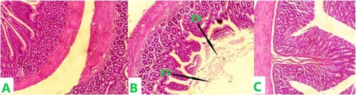 Figure 1. The histological section of the duodenum following the administration of MEZO in female Wistar rats.Note: Plate A represents the control and was administered only distilled water for 21 days. Plate B received 200 mg/kg MEZO for 21 days. Plate C received 400 mg/kg MEZO 21 days. EV - Eroded villi. Staining for all sections was done using H&E and photomicrography was taken at x200.