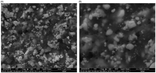Figure 4. Scanning electron microscopy (SEM) of Hugonia mystax silver nanoparticles (A. 25 000X; B. 50 000X).